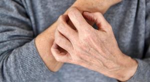 Зуд кожи тела у пожилых людей: причины и лечение